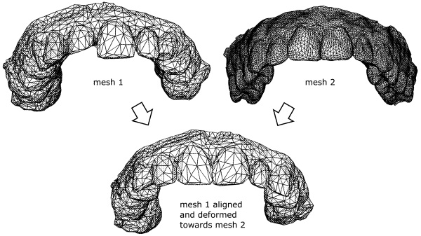 Rendering of dental models